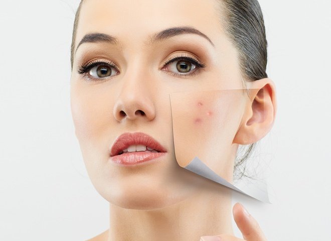 Крем Diabetegen Диабетеген от кожных проблем, прыщей, акне